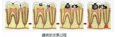 微信截图_20170220101929.png