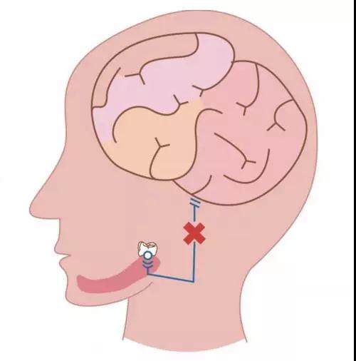 智齿科普示意图 赛德阳光口腔