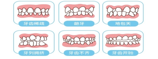 2分钟带你了解牙齿深覆合