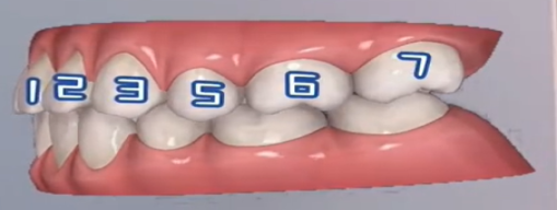 嘴突怎么选：推磨牙or拔牙？