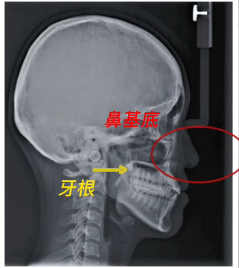 鼻基底