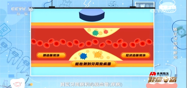 赛德阳光口腔创始人周彦恒教授指出：“研究已证实，牙周病与糖尿病、冠心病等全身性疾病存在关联。”