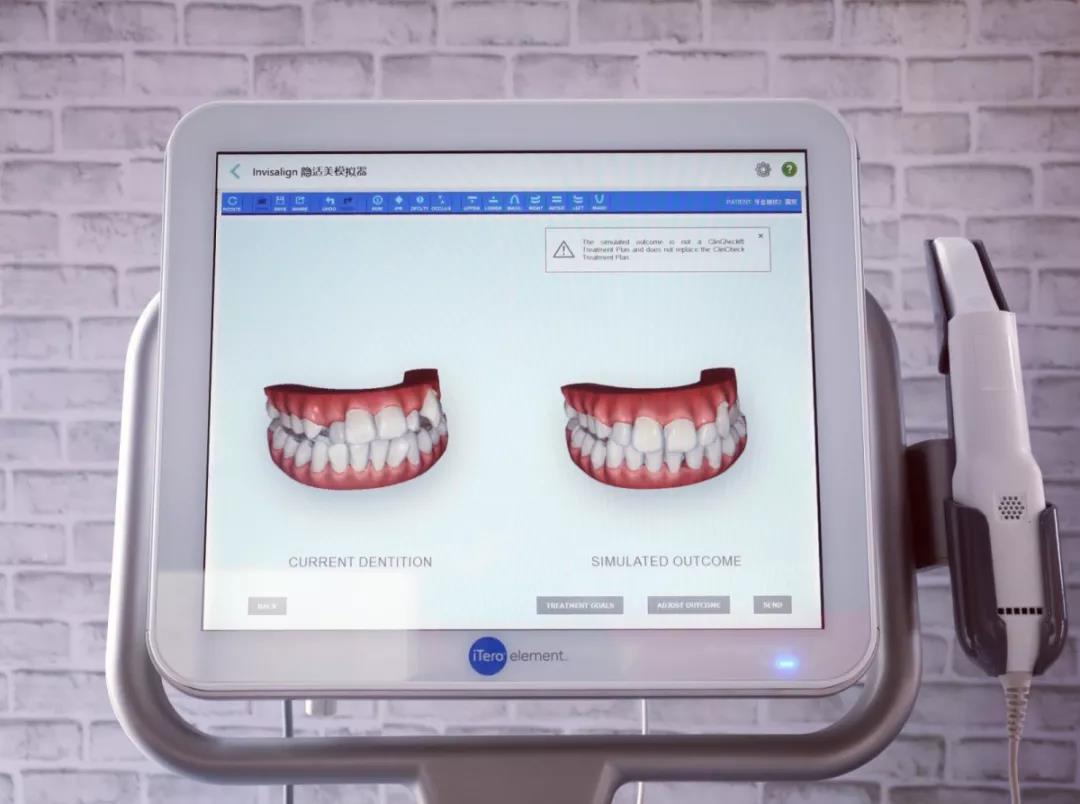 健亚医疗科技（上海）有限公司-STAR 3D打印令你的牙科诊治更快完成~